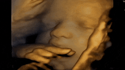 4D Ultra Sound Clip