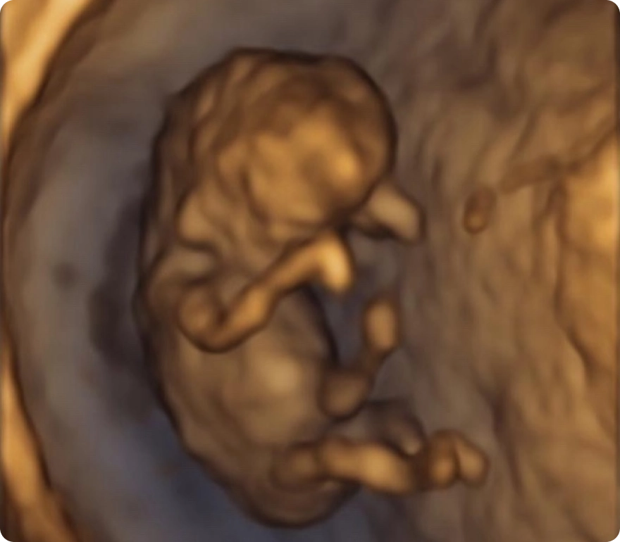 The Mini Ultrasound Package 1