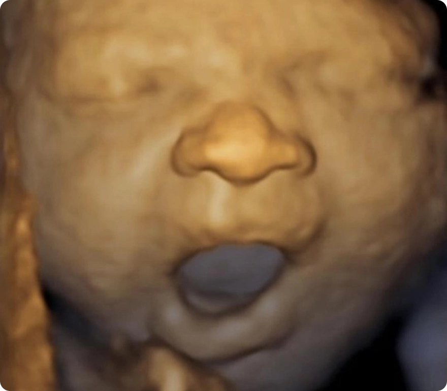 The Platinum Package 1