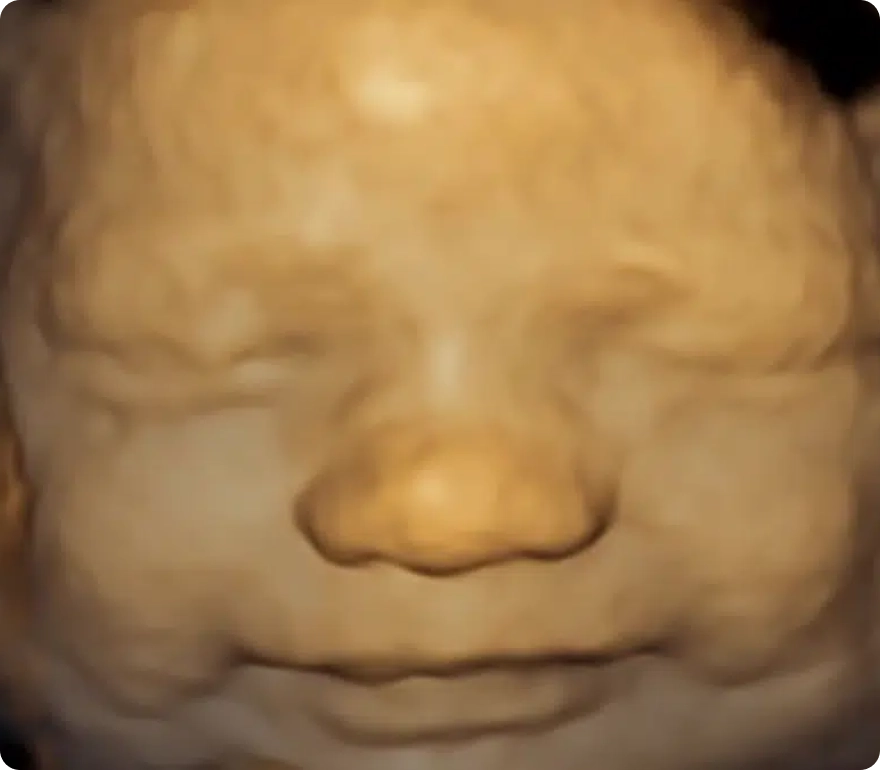 what-is-a-4d-ultrasound-blog