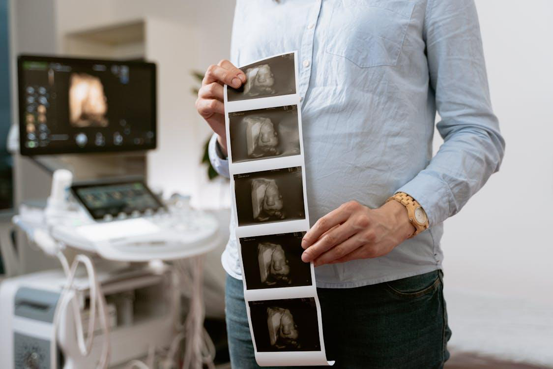A woman holding print of her baby’s ultrasounds