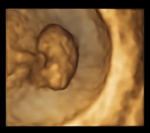 A closeup shot of a sonogram