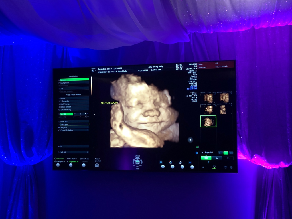 A baby in the womb smiling in a detailed ultrasound