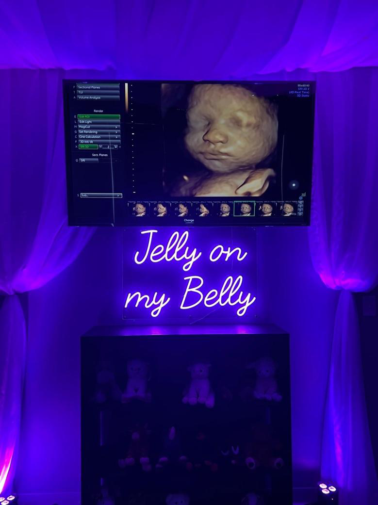 A baby on the ultrasound screen at Jelly on my Belly