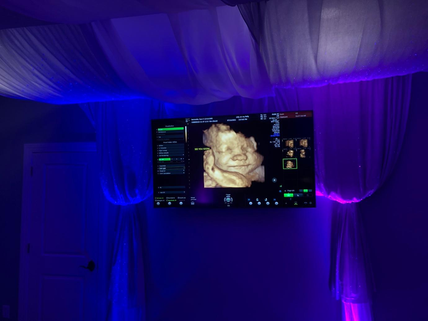 A baby in the womb smiling on the screen