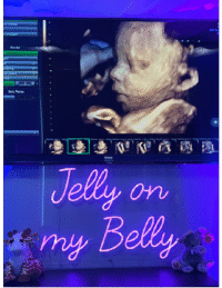 HD ultrasound image of a baby on the screen