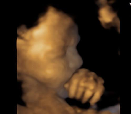 A baby in an ultrasound